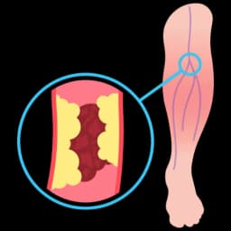 Skin Discoloration